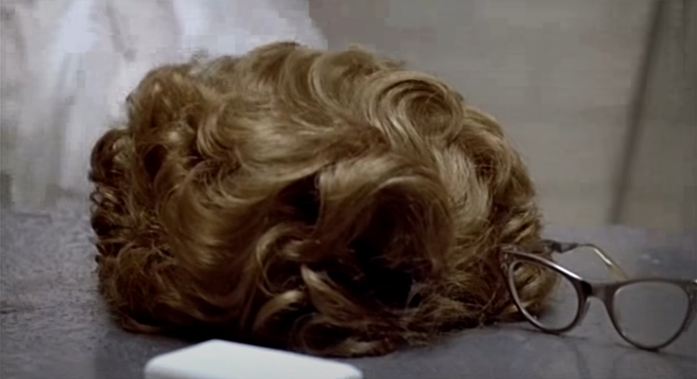 A man loses his hair in that brief moment of radiation exposure (Source - movie Silkwood)
